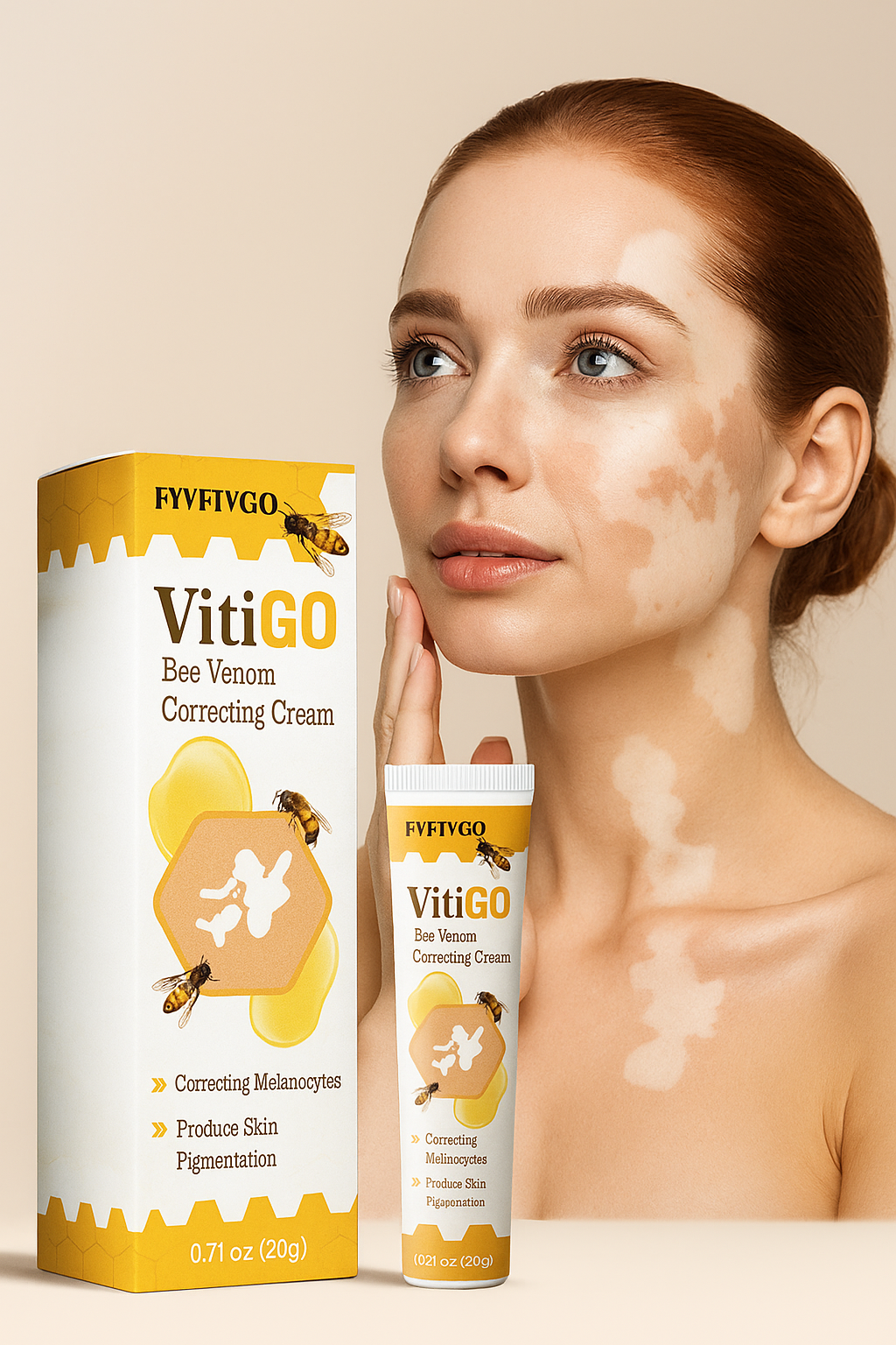 Vitigo Bee Venor Correcting Cream (Buy 1 Get 1 Free)